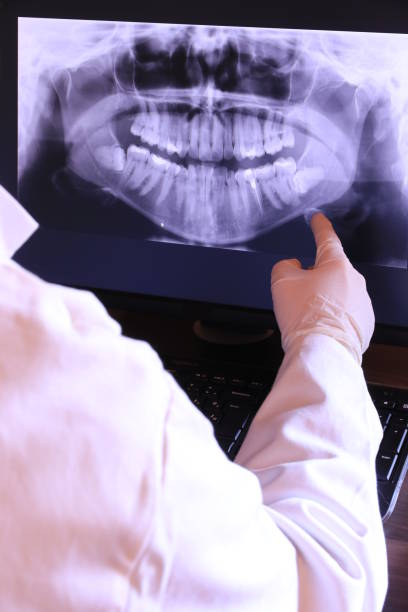 Best Emergency Wisdom Teeth Removal in Gregory, SD